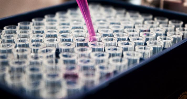 Számos problémát okozhat, ha rendszertelenül működik a pajzsmirigyünk