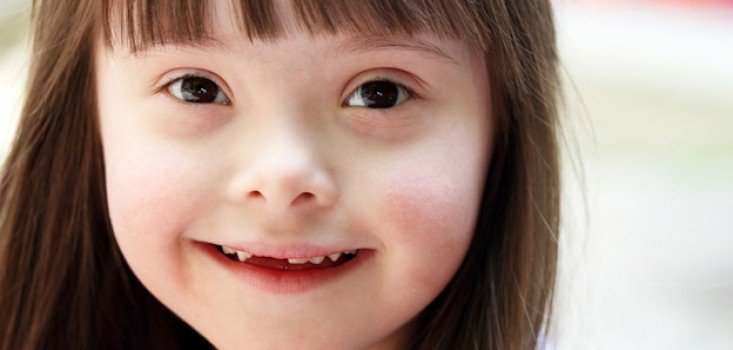 A három 21-es kromoszómáról