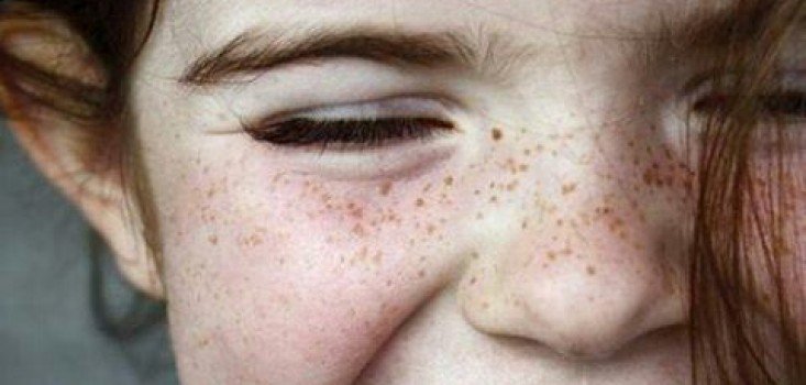 Figyelemhiányos hiperaktivitás-zavar II.rész