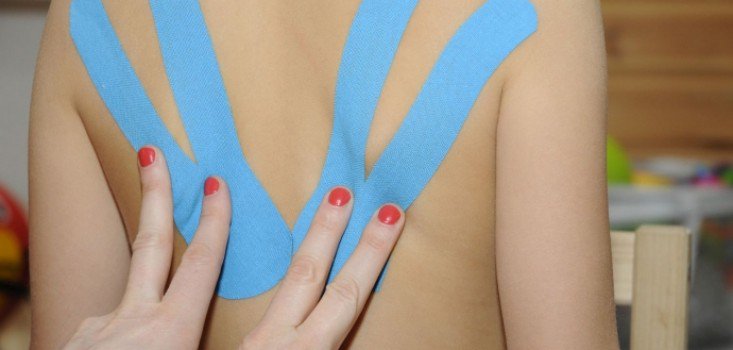 Színes korrigáló matrica avagy a Kinesio taping terápia