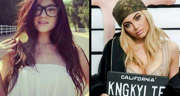 Ennyit változtak a sztárok az első Instagram fotójuk óta