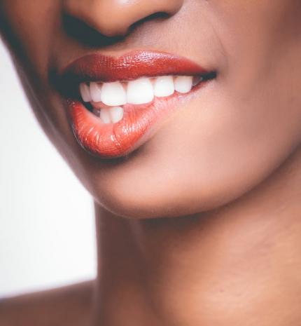 Ha már elkezdtem, legyen tökéletes- Fogszabályozásom története