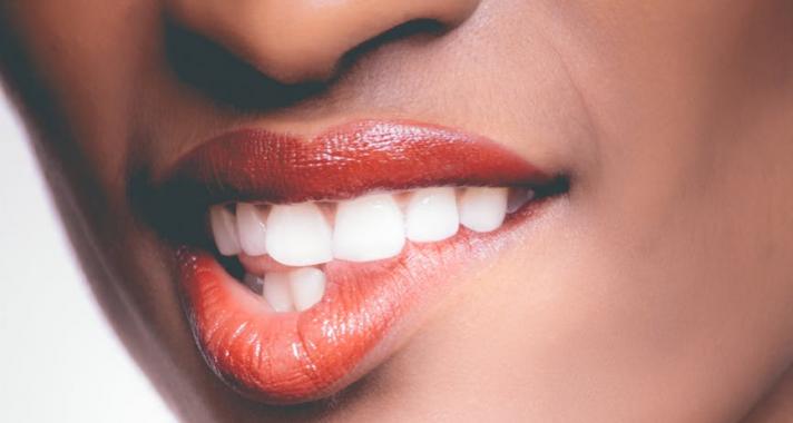 Ha már elkezdtem, legyen tökéletes- Fogszabályozásom története