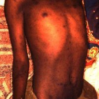 Régi idők járványai, betegségei - Stílus, divat, életmód, stílus