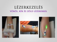 Forradalmian új anti-aging eljárás - E-régi, divat, életmód, stílus