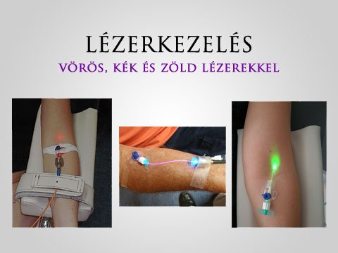 Forradalmian új anti-aging eljárás