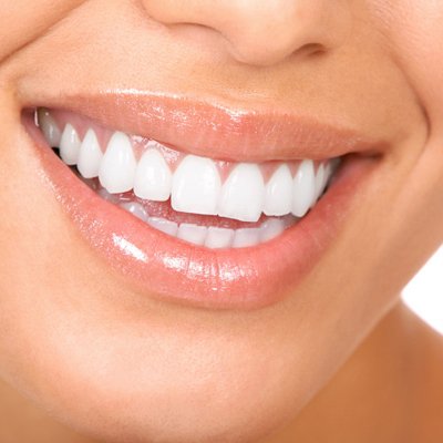 A hófehér hollywoodi mosoly története