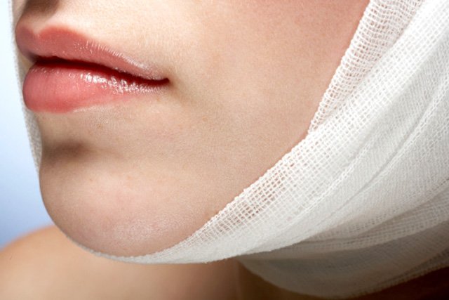 Természetes vagy művi szépség?