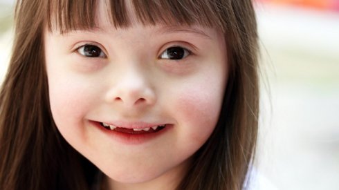 A három 21-es kromoszómáról