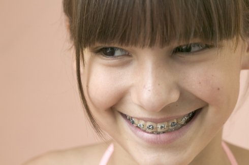 Iskolai szünetben szépülnek a fiatalok