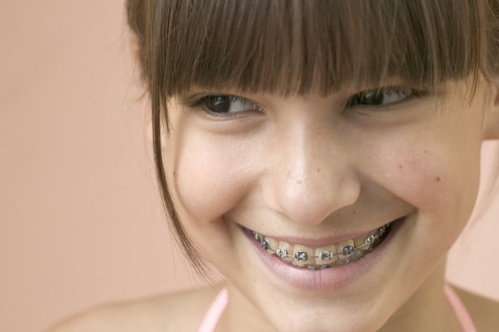 Iskolai szünetben szépülnek a fiatalok