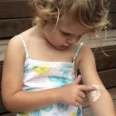 Pikkelysömör: mire figyeljünk nyáron? - Stylelife, divat, életmód, stílus