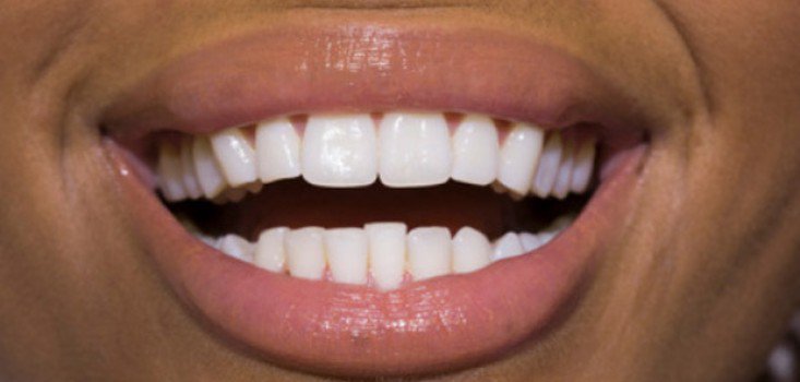 Legyél te is szakértő a szájápolásban!