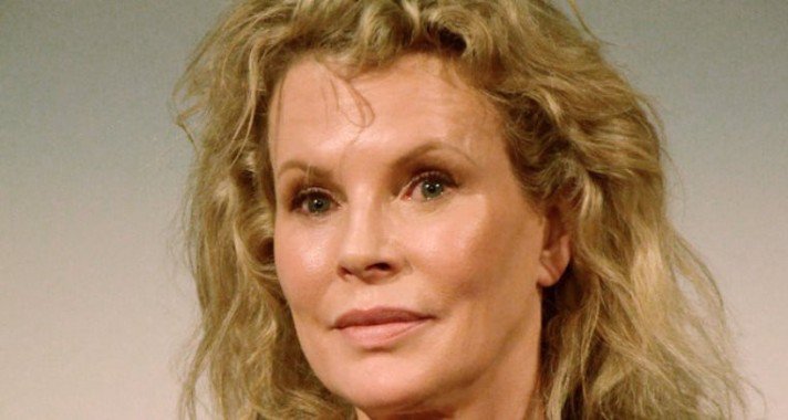 A legnagyobb hollywood-i botoxkatasztrófák