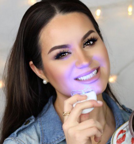 Amit tudni érdemes az otthoni fogfehérítésről